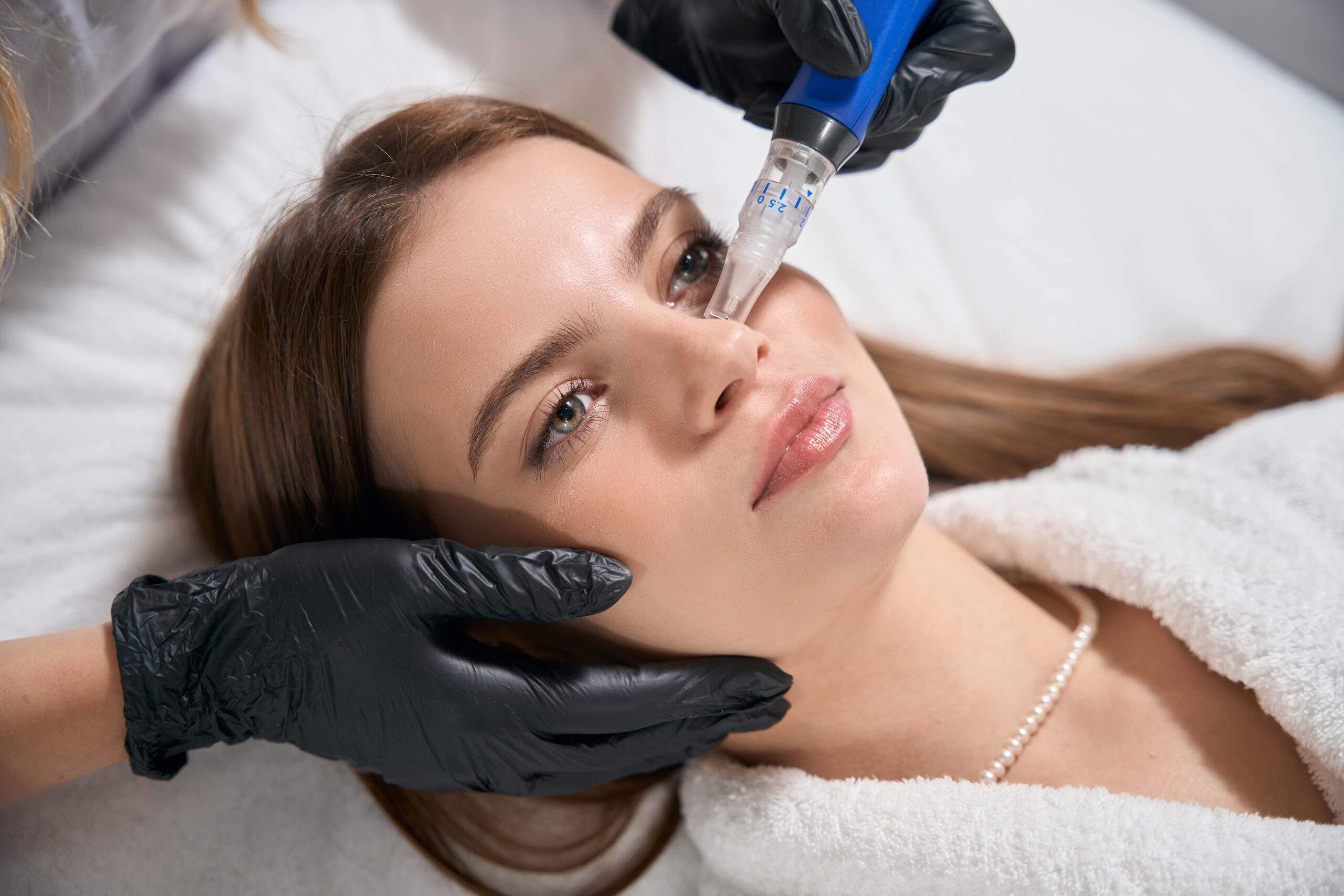 Microneedling